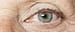 glaucoma checkup