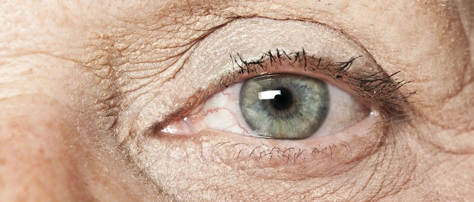 glaucoma checkup