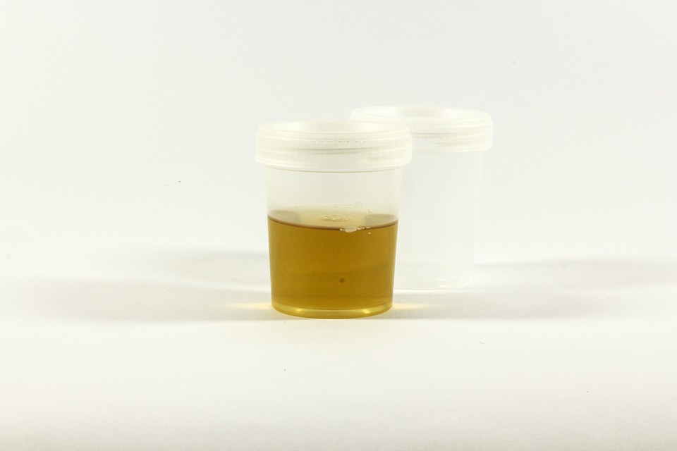 urine in container