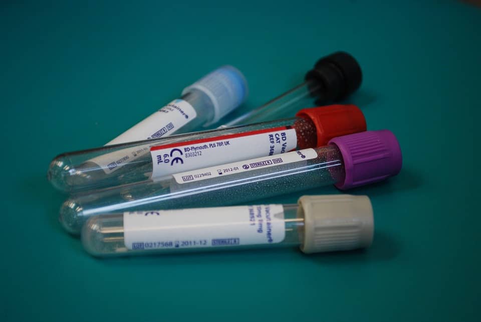 lab sample tubes